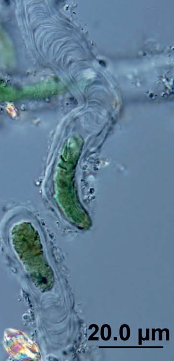 图4 现代Solentia stratosa(Vondrá?ková et al., 2017)